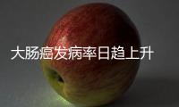 大肠癌发病率日趋上升 40~60岁男性好发