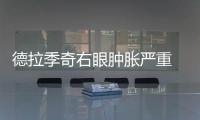 德拉季奇右眼肿胀严重 热火主帅调侃：就像洛奇